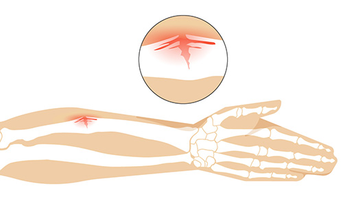 noleggio magnetoterapia  Ancona